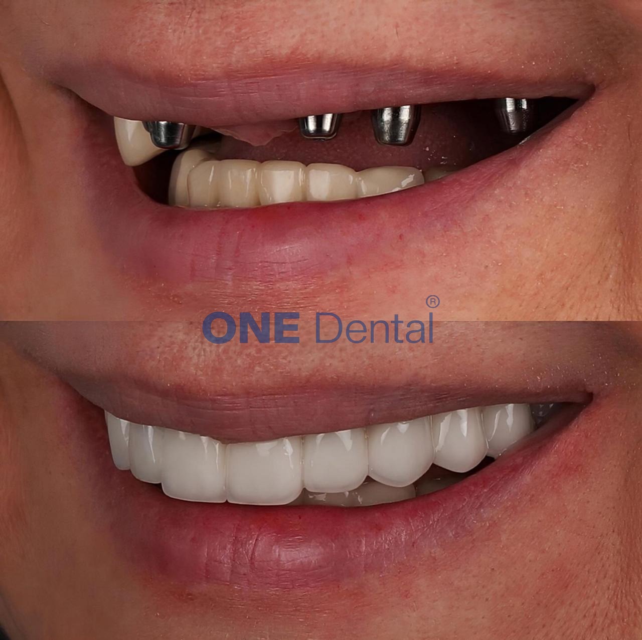 one clinic dental 3
