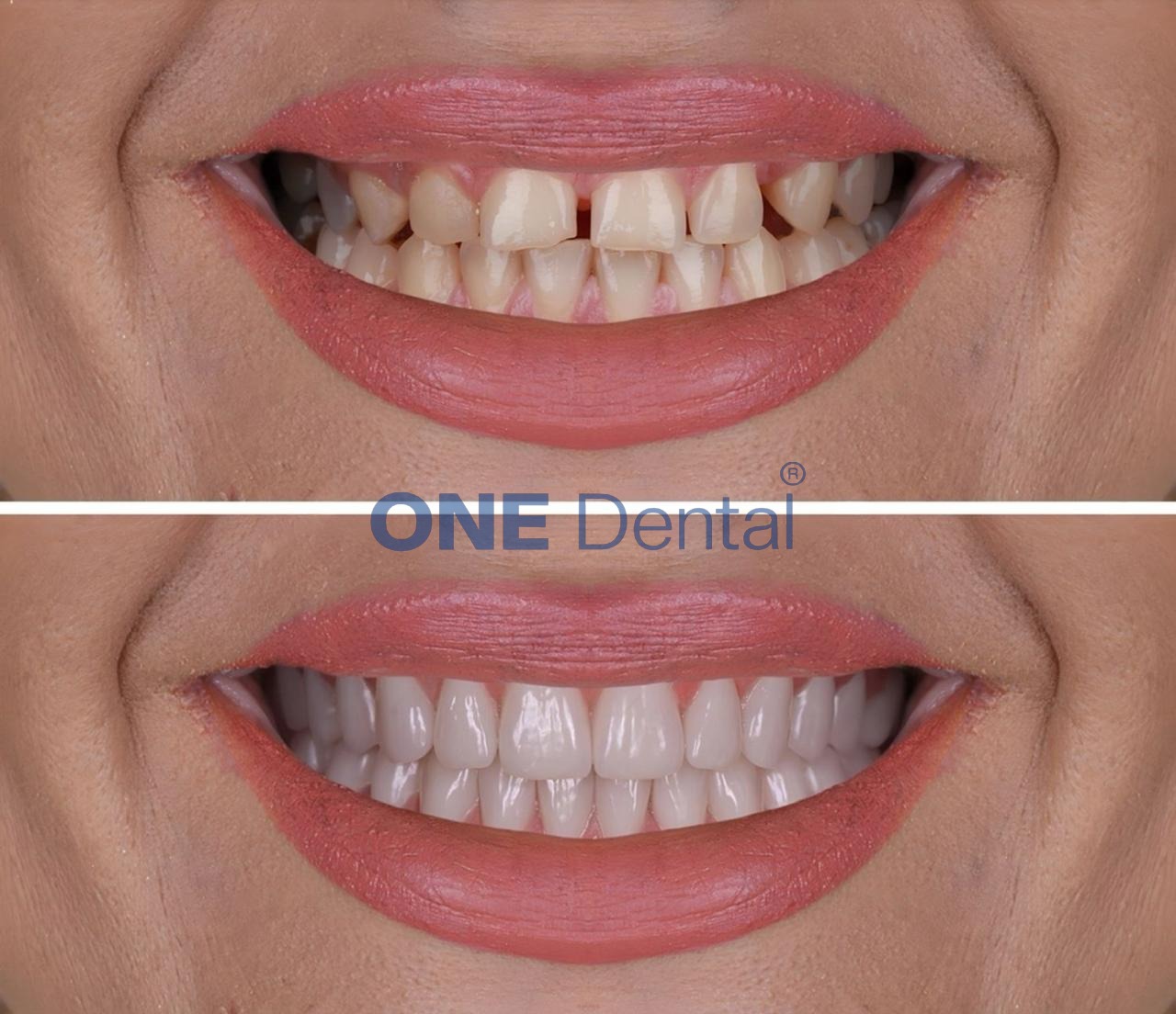 one clinic dental 4