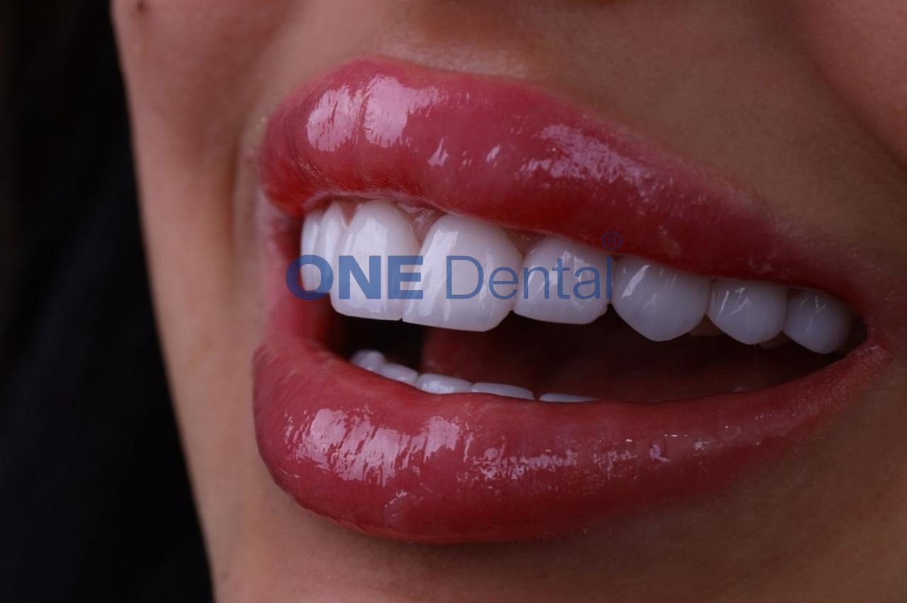 one clinic dental 5