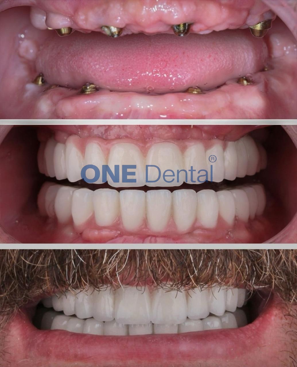one clinic dental 6